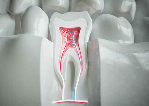 歯髄再生治療とは？